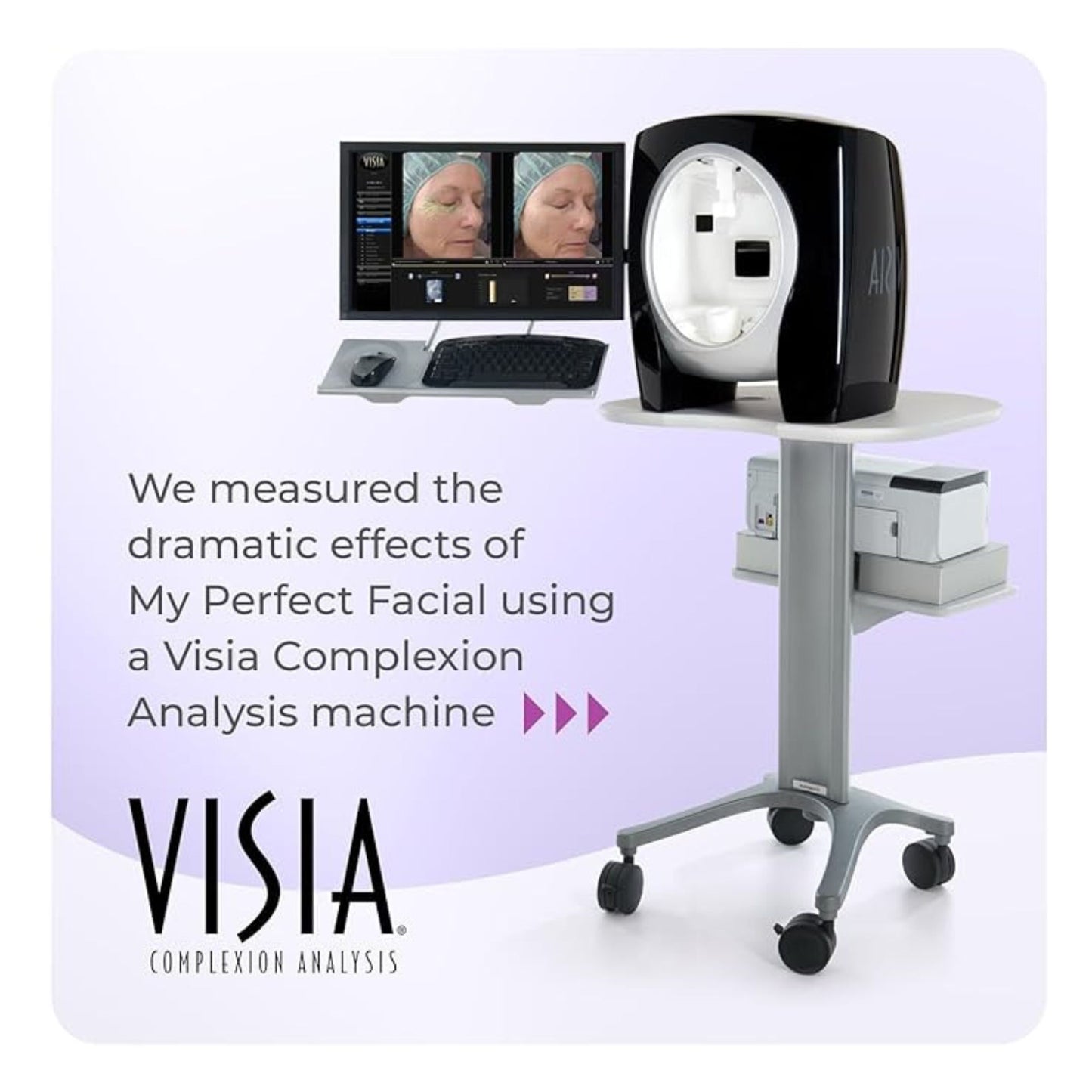 My Perfect Facial, Penny Lane, 10 Treatment Kit, Instant Results, Clinically Proven, Anti-Ageing 3-Stage Facial Contouring and Skin Tightening System. Salon Grade Results, As Seen on TV